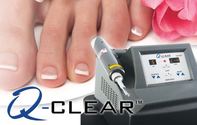 laser-toe-treatment-podiatry-of-arlington-heights