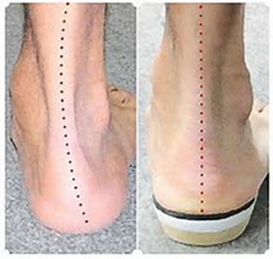 ankle