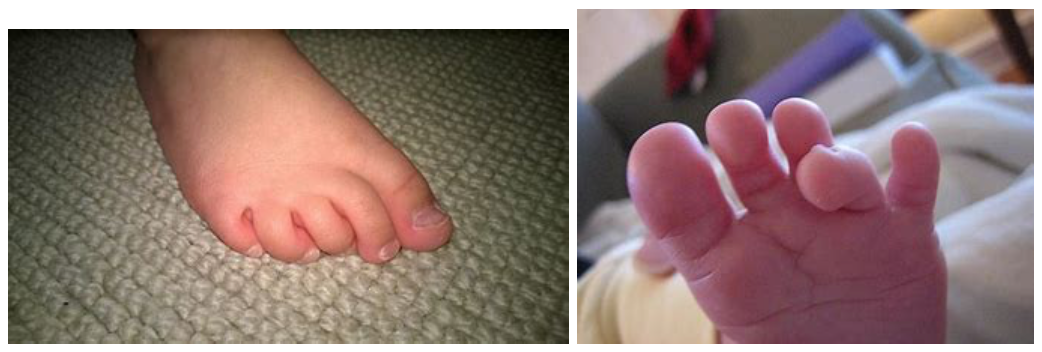 curly-toes-podiatry-of-arlington-heights