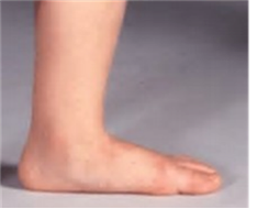 foot